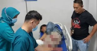Pelaku spesialis Curanmor yang sudah beraksi di 12 TKP di Palembang, Ari Wahono (27) mendapat perawatan, Selasa (7/11/2023). Foto : Sumselheadline/Ela.