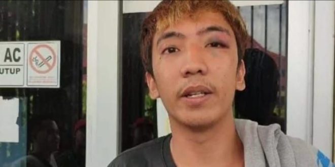 Satria dengan mata kirinya yang lebam dipikul, Jumat (3/5/2024). Foto: Sumselheadline/Ela.