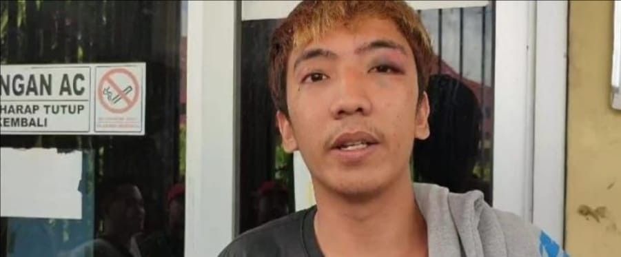 Satria dengan mata kirinya yang lebam dipikul, Jumat (3/5/2024). Foto: Sumselheadline/Ela.