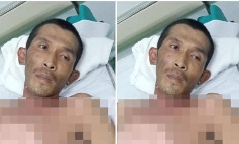 Fandi yang tergeletak loemas usai kesetrum listrik saat bekerja di sebuah rumah reflexsi, Senin (29/7/2024). Foto: Sumselheadline/Ela.