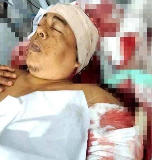 Yunus, seorang pria warga RT 07, RW 11, Desa Ibul I, Kecamatan Pemulutan, Kabupaten Ogan Ilir (OI), meregang nyawa usai duel maut di depan pintu tol, Selasa (6/8/2024). Foto: Dok Polisi.