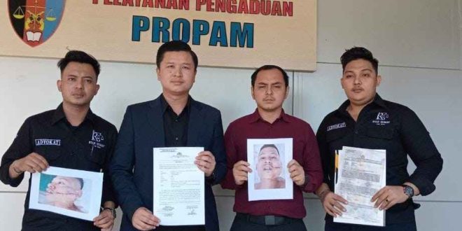 Melalui kuasa hukumnya, korban kasus penganiayaan Sandi Fajri (29) mendatangi Bid Propam Polda Sumsel, melaporkan Kapolsek Talang Kelapa. Foto: Sumselheadline/Ela.