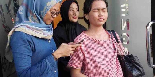 Kondisi korban yang kini buta, akibat kasus malapraktek oknum bidan di Palembang. Foto: IST