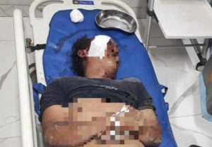 Gareng, ditemukan meninggal dunia setelah dihajar warga. Dia diduga kepergok memerkosa anak di bawah umur, Sabtu (7/12/2024). Foto: Sumselheadline/Ela.