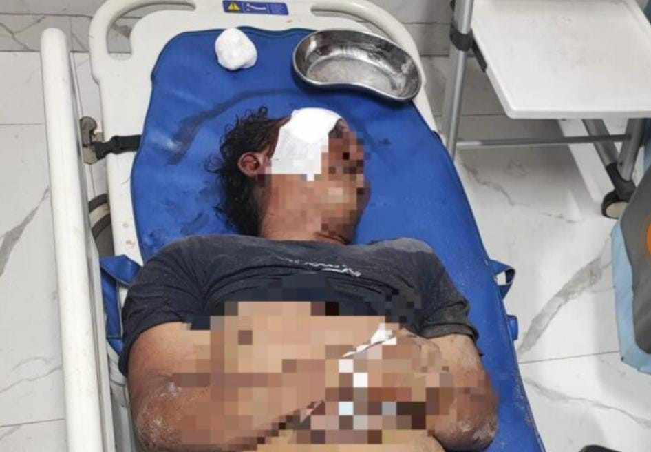 Gareng, ditemukan meninggal dunia setelah dihajar warga. Dia diduga kepergok memerkosa anak di bawah umur, Sabtu (7/12/2024). Foto: Sumselheadline/Ela.